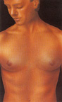 Postoperative appearance male breast reduction photo